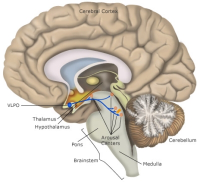 The ventrolateral preoptic nucleus (VLPO) promotes sleep by inhibiting activity in the brain's arousal centres (image from Healthy Sleep)